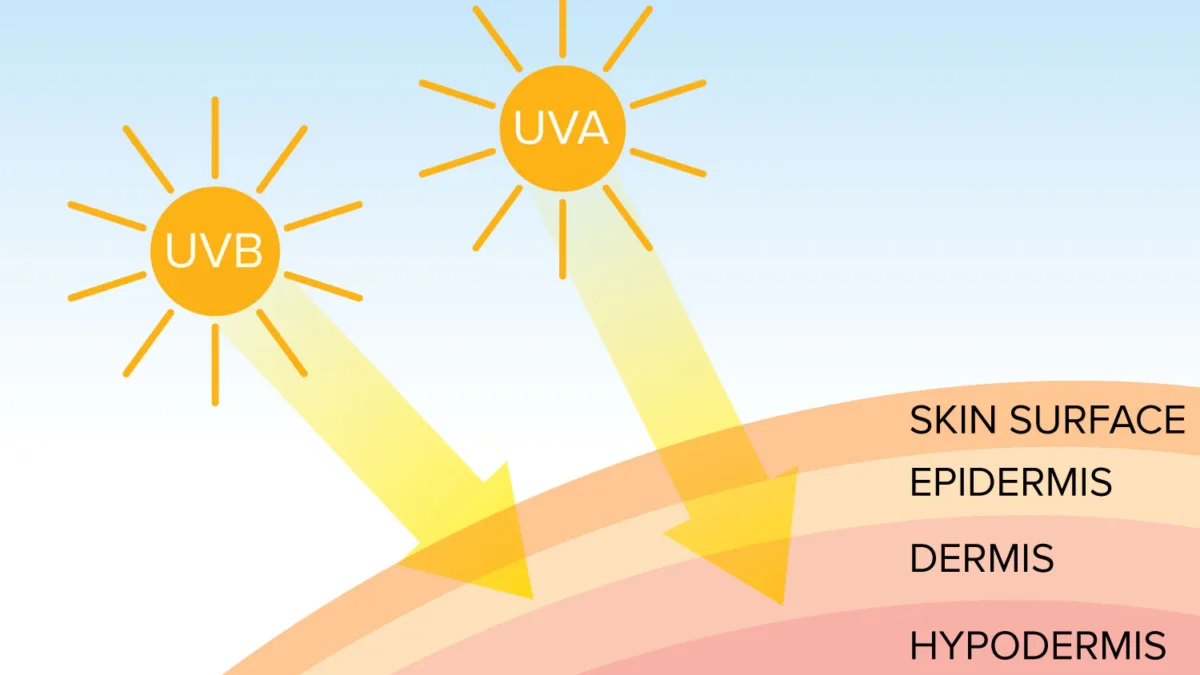 The Connection Between Sun Exposure and Skin Cancer