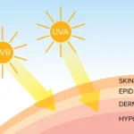 The Connection Between Sun Exposure and Skin Cancer