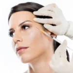 Things to Consider Before Starting Neurotoxin Treatments