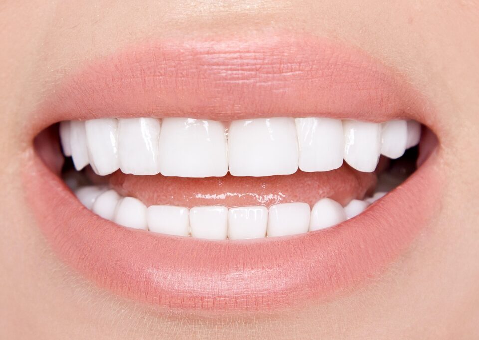 The Different Types of Veneers and Their Unique Benefits